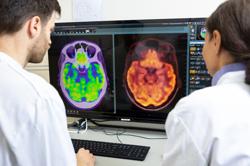 Operative Epilepsiebehandlung im Arzt-Patienten-Dialog | 9. April 2026